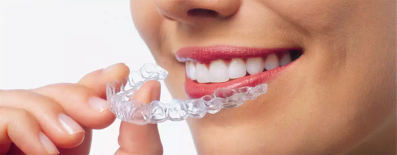 Tandretning med Invisalign eller ClearCorrect